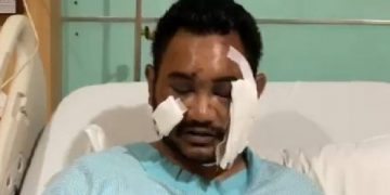 Polda DIY Janji Selesaikan Kasus Penganiayaan Dengan Adil