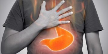 Waspada! Ini 13 Makanan & Minuman yang Dapat Memicu GERD dan Asam Lambung Naik