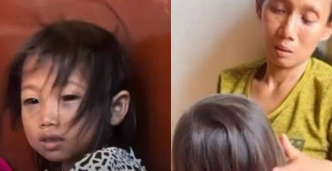 Siswi SD di Palembang Alami Mata Lebam, Orangtua Lapor Polisi Dugaan Dianiaya Guru