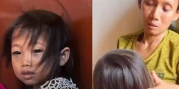 Siswi SD di Palembang Alami Mata Lebam, Orangtua Lapor Polisi Dugaan Dianiaya Guru